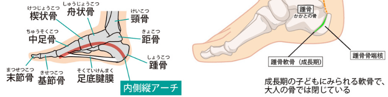 踵骨骨端症とは